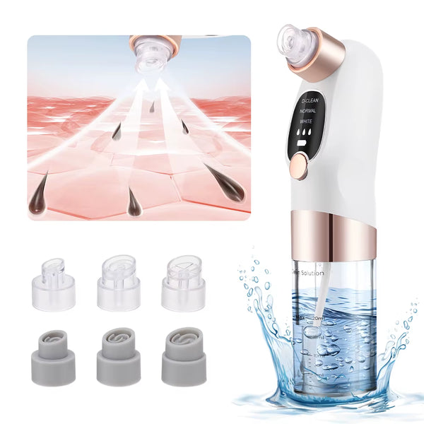 PoreClear™ Electric Blackhead Remover – Deep Cleansing Vacuum with Water Circulation Technology