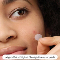 PurePatch™ Acne Spot Patches – Gentle Hydrocolloid Blemish Covers for Overnight Care