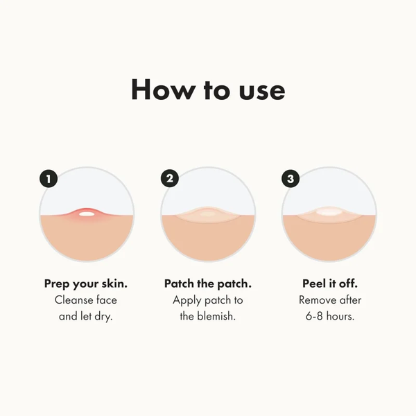 PurePatch™ Acne Spot Patches – Gentle Hydrocolloid Blemish Covers for Overnight Care