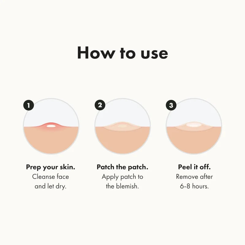PurePatch™ Acne Spot Patches – Gentle Hydrocolloid Blemish Covers for Overnight Care