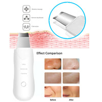 PoreWave Pro™ Ultrasonic Skin Scrubber – Deep Pore Cleanser & Facial Exfoliating