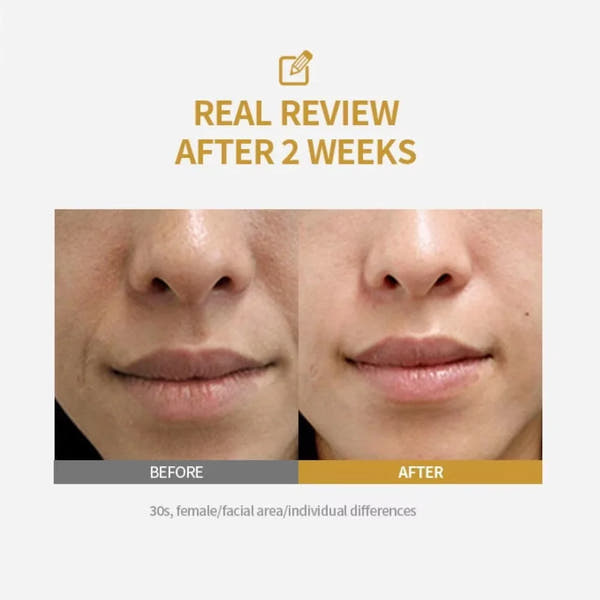 DermaLift™ Collagen Peptide Serum - Intensive Firming, Deep Hydration & Glass Skin Radiance