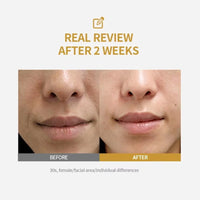 DermaLift™ Collagen Peptide Serum - Intensive Firming, Deep Hydration & Glass Skin Radiance