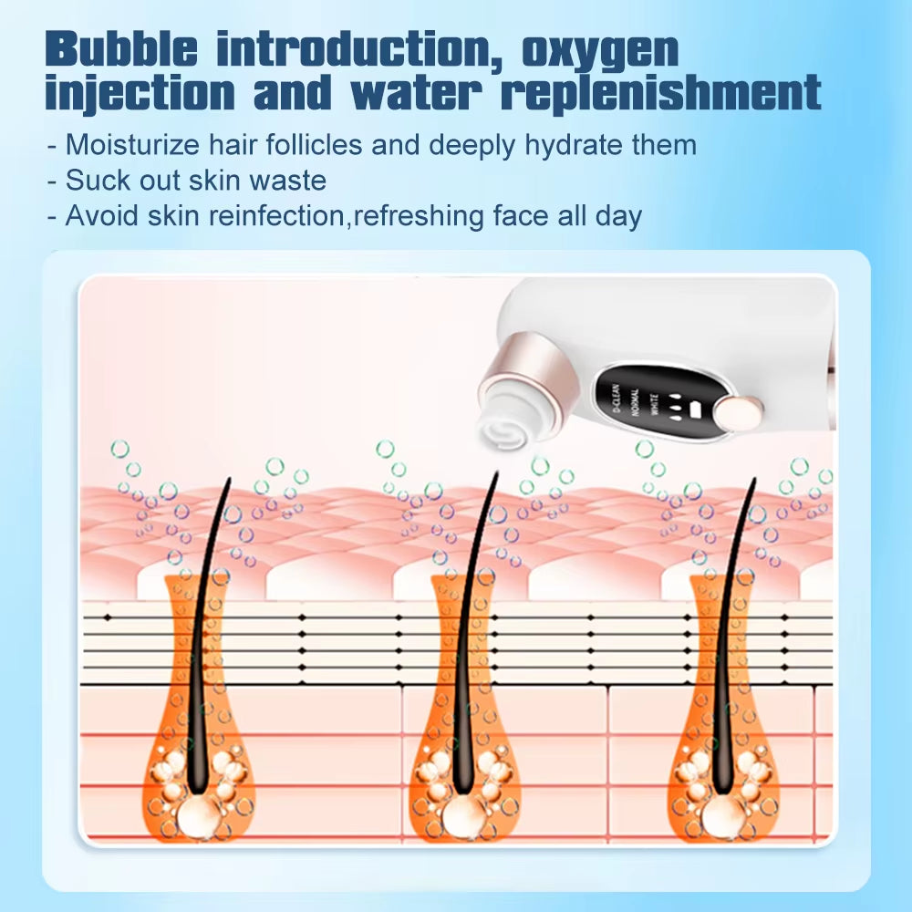 PoreClear™ Electric Blackhead Remover – Deep Cleansing Vacuum with Water Circulation Technology