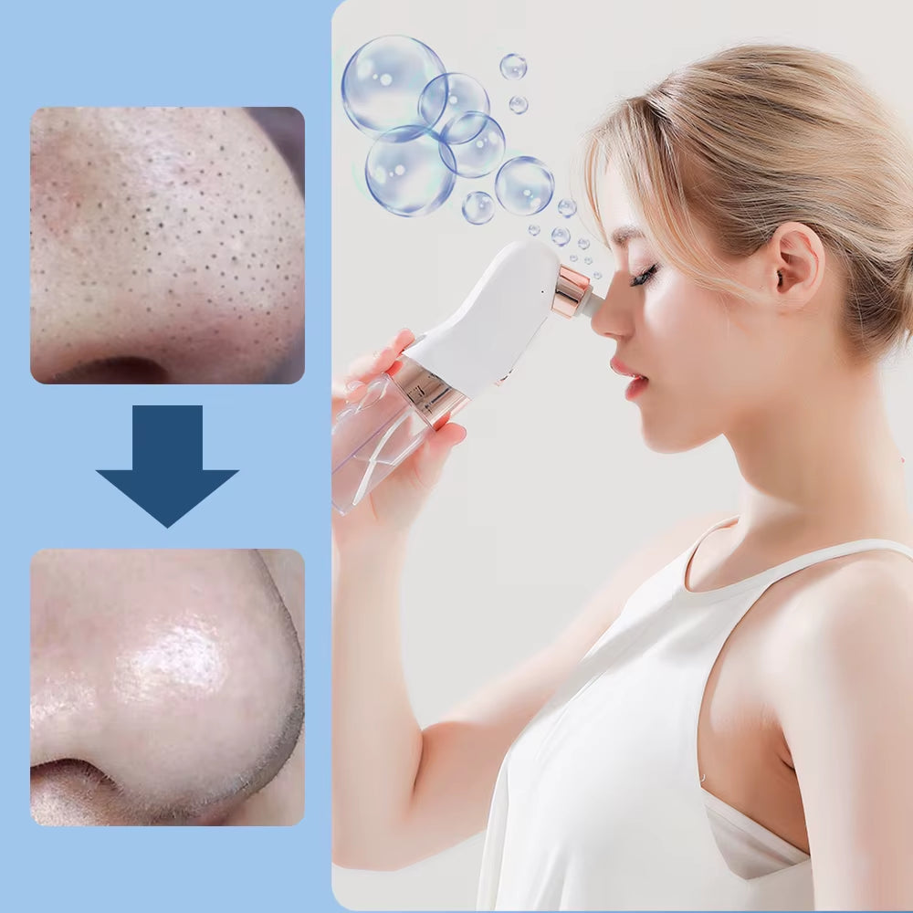 PoreClear™ Electric Blackhead Remover – Deep Cleansing Vacuum with Water Circulation Technology