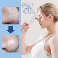 PoreClear™ Electric Blackhead Remover – Deep Cleansing Vacuum with Water Circulation Technology